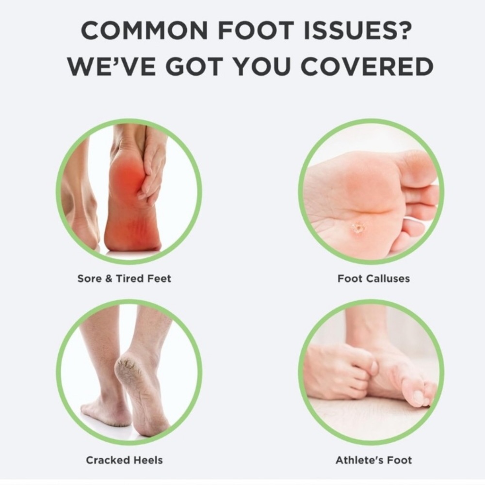 Foot Callus Remover Gel Set - Picture 5 of 5